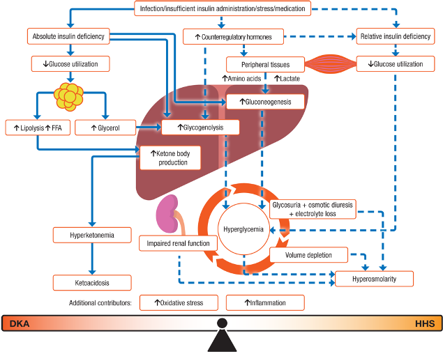 Hyperglycemic crises in adult with diabetes